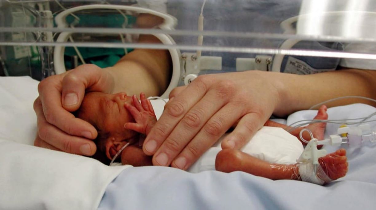 FLASH - Il miracolo di Lorenzo, il bimbo piuma nato a 4 mesi 1